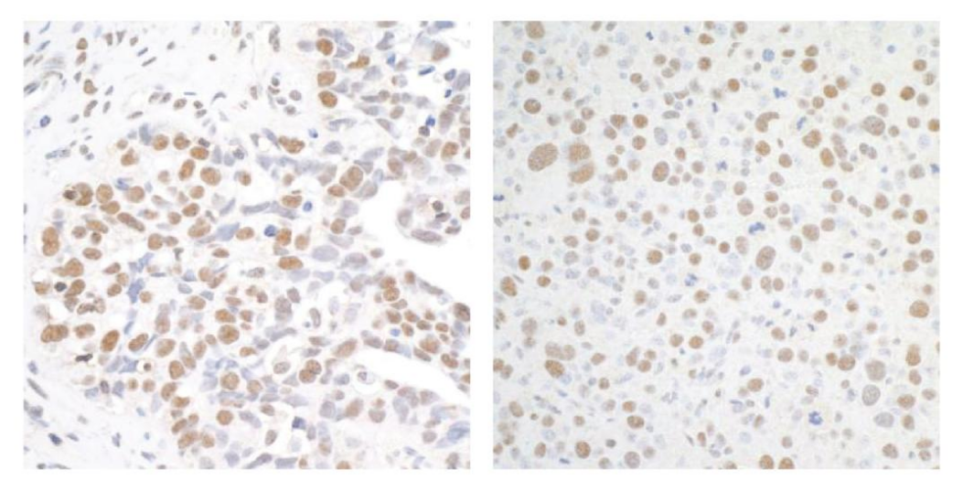 Immunohistochemistry data.png