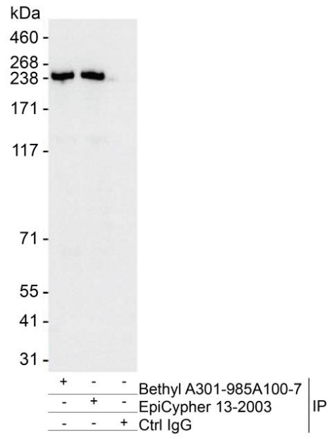 Immunoprecipitation data.png