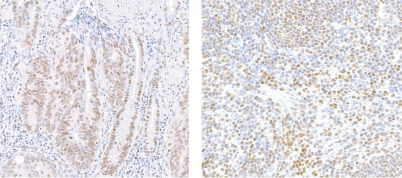 Immunohistochemistry data.png