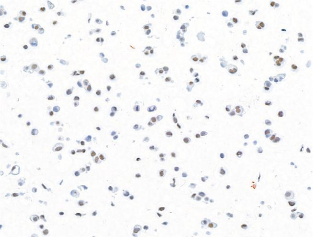 Immunocytochemistry data.png