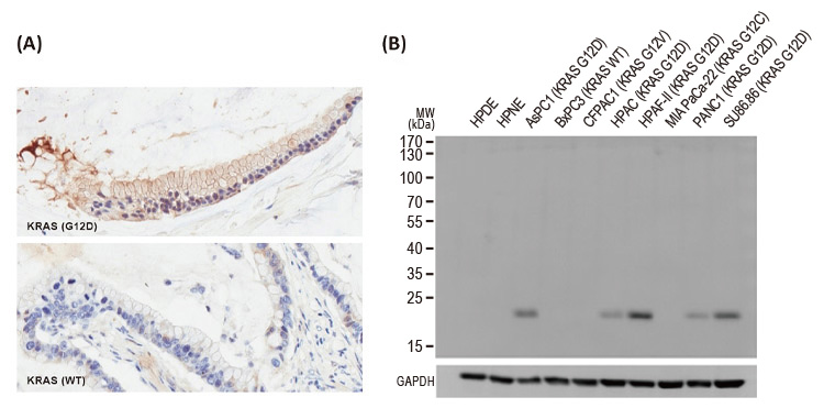 RAS (G12D Mutant) antibody [HL10](GTX635362）