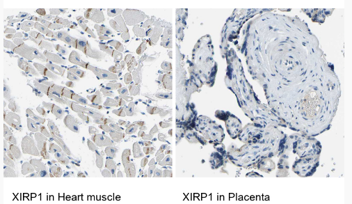 Anti-XIRP1.png