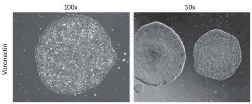 Vitronectin