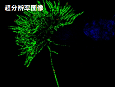 牛呼吸道上皮细胞纤毛虫超高清染色图.png