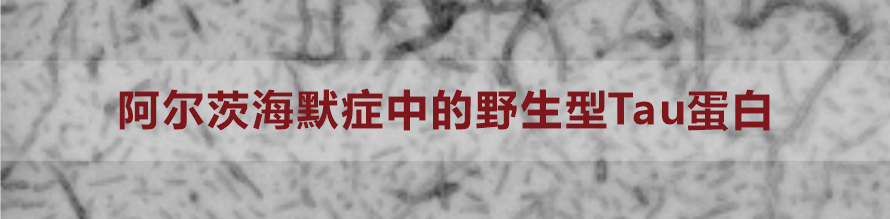 野生型Tau蛋白.png