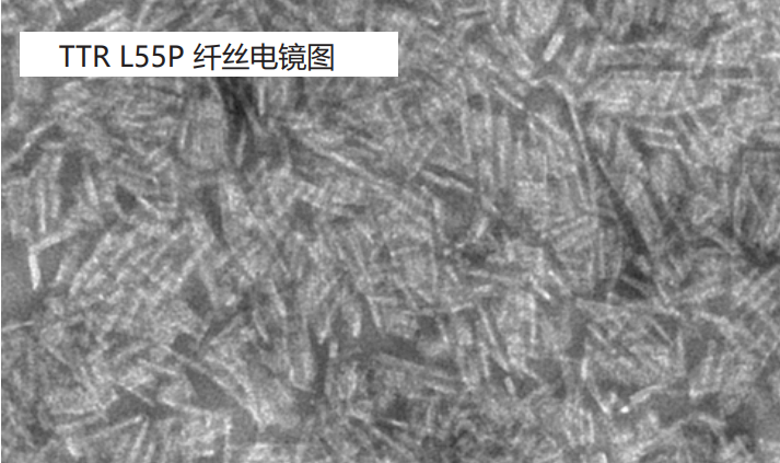 TTR L55P 纤丝电镜图.png